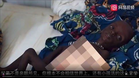 烏干達兒童最真實<em>的</em>生活狀態(tài)