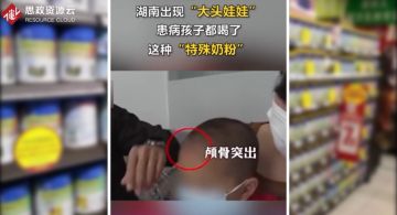 <em>湖南</em>郴州多家母嬰店將蛋白粉充當奶粉售賣，導致多名兒童患上佝僂病