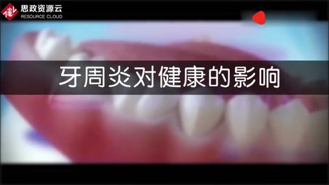 牙周炎病變過程及刮治，3D動畫演示